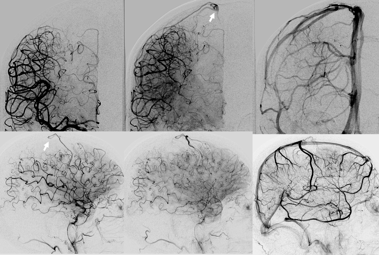 . Journal of comparative neurology . Fig. 11 Parasagittal section near median surface of mandibular nerve, embryoof pig 17 mm. in length. E, eustachian tube; Jug, jugular vein; Man, mandibu-lar nerve; Ot, otic ganglion; *S, semilunar ganglion. Fig. 12