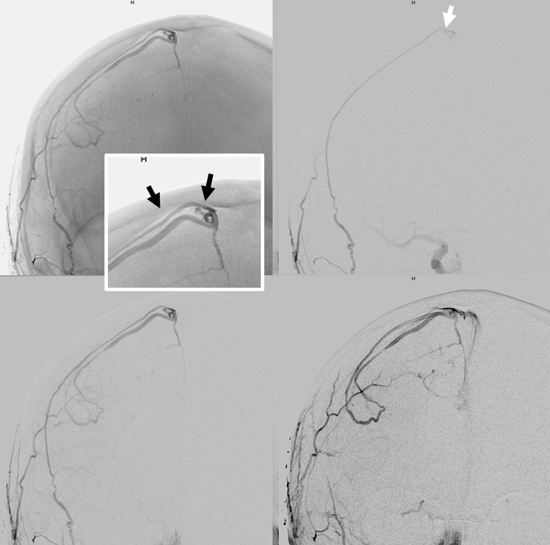 . Journal of comparative neurology . Fig. 11 Parasagittal section near median surface of mandibular nerve, embryoof pig 17 mm. in length. E, eustachian tube; Jug, jugular vein; Man, mandibu-lar nerve; Ot, otic ganglion; *S, semilunar ganglion. Fig. 12