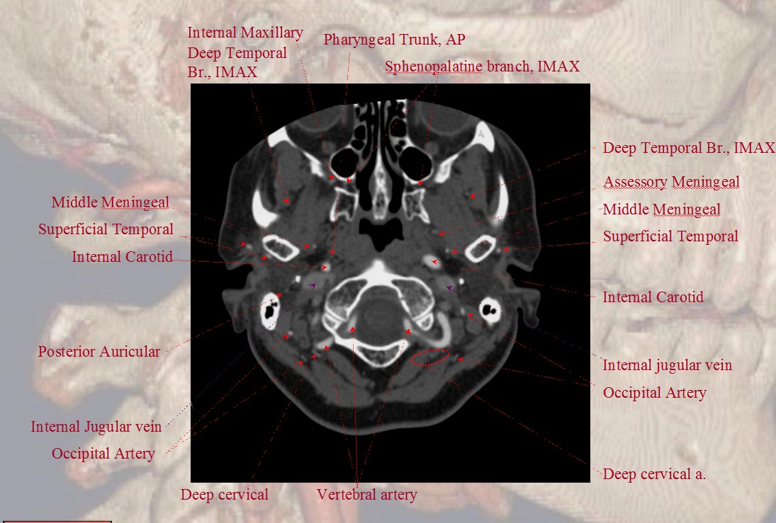 Occipital Artery