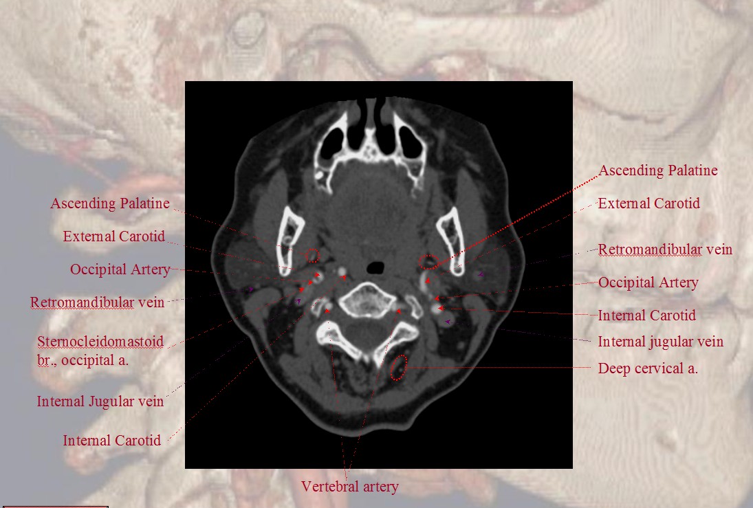 Label The Ct Scan Of The Neck Ct Scan Machine