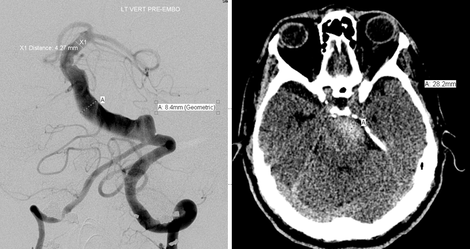 Head ct scan interpretation ppt presentation