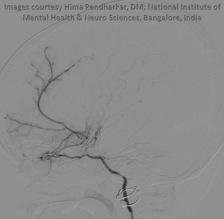 Ventral Ophthalmic Artery