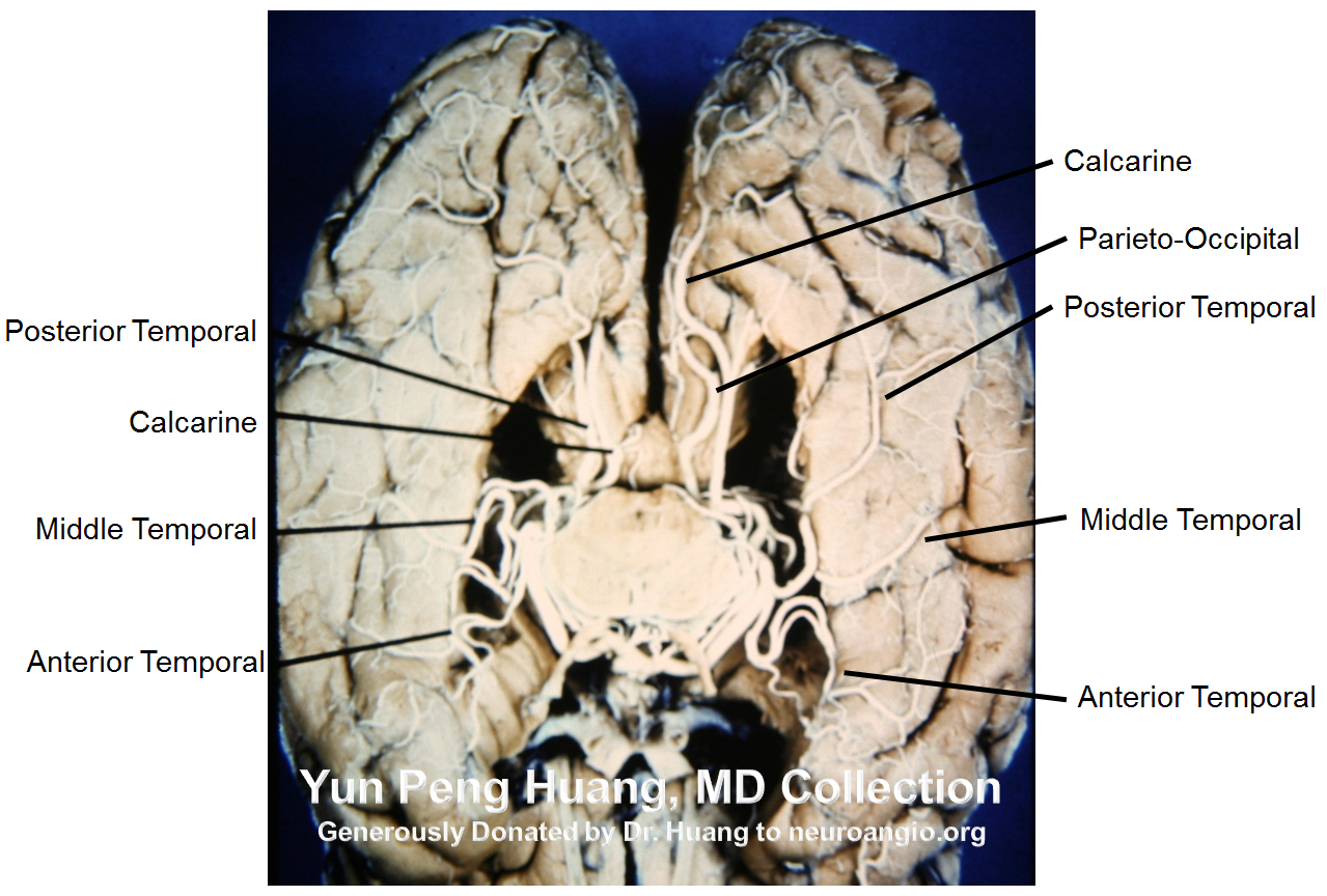 PCA specimen photo