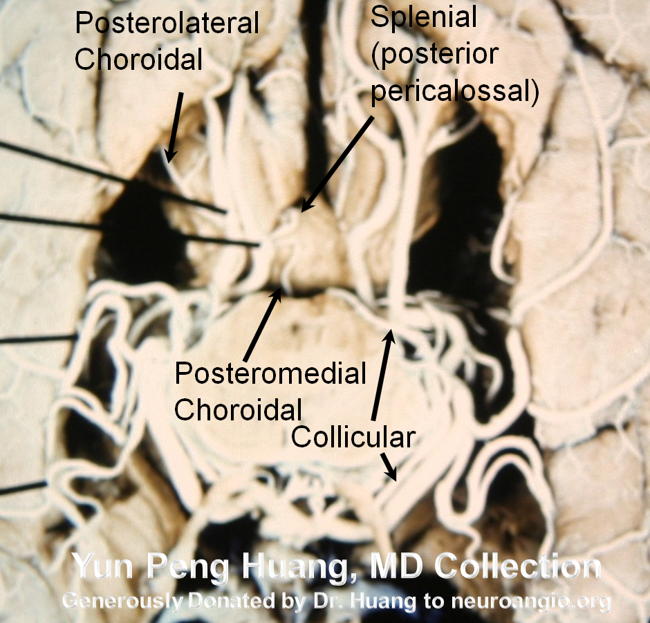 PCA specimen photo detail