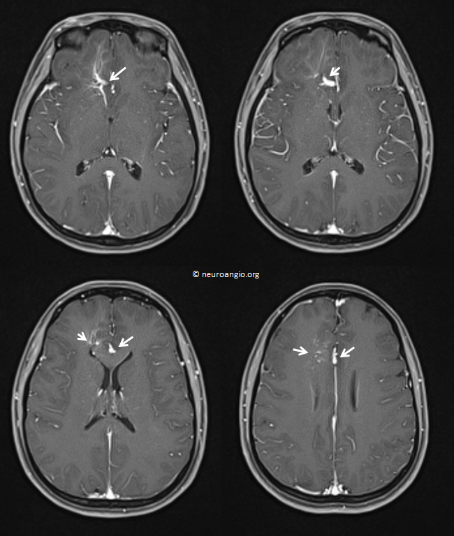 Patient Information DVA