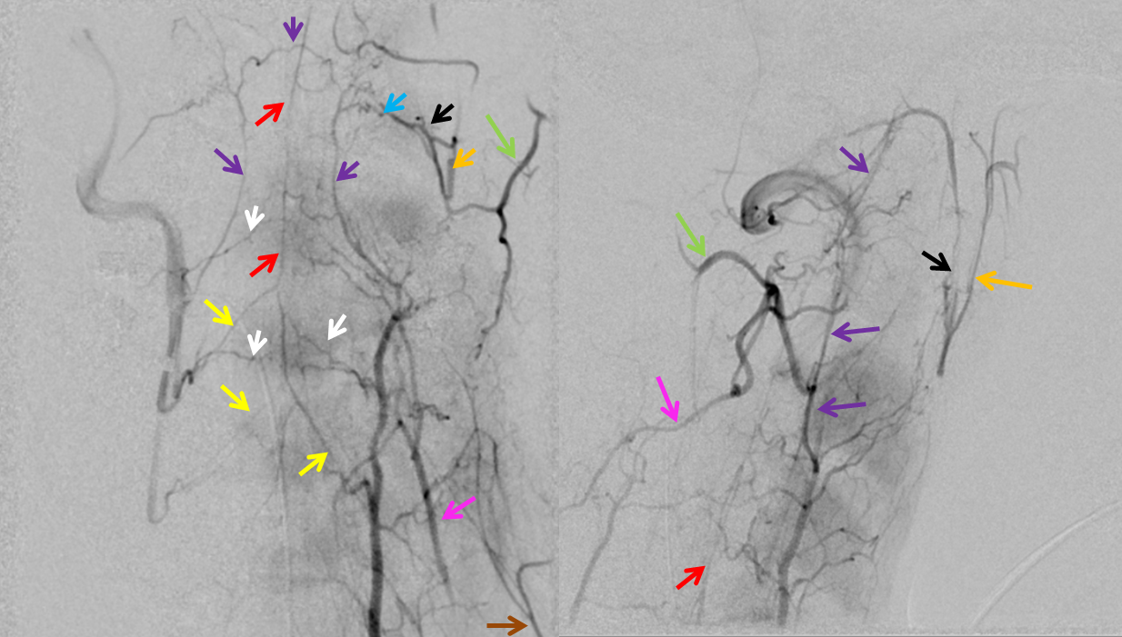 vertebral artery anastomoses