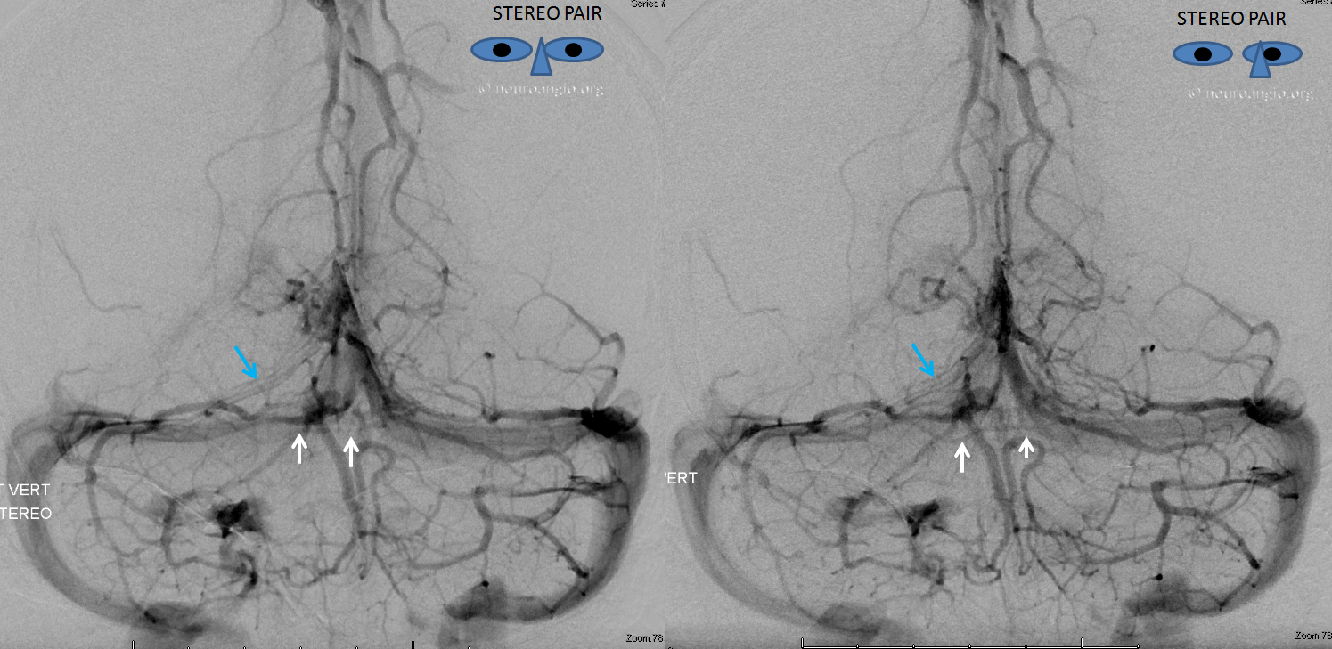 basal vein