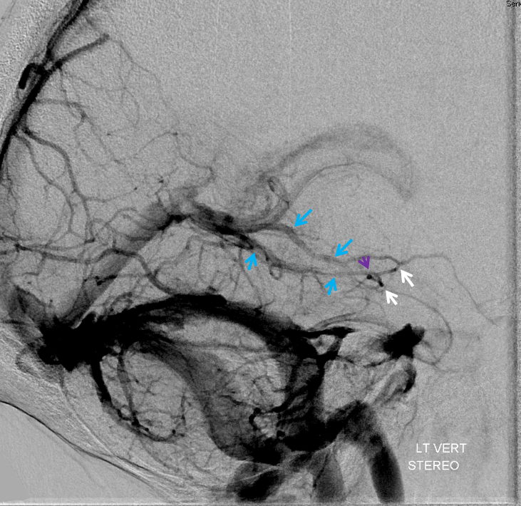 basal vein