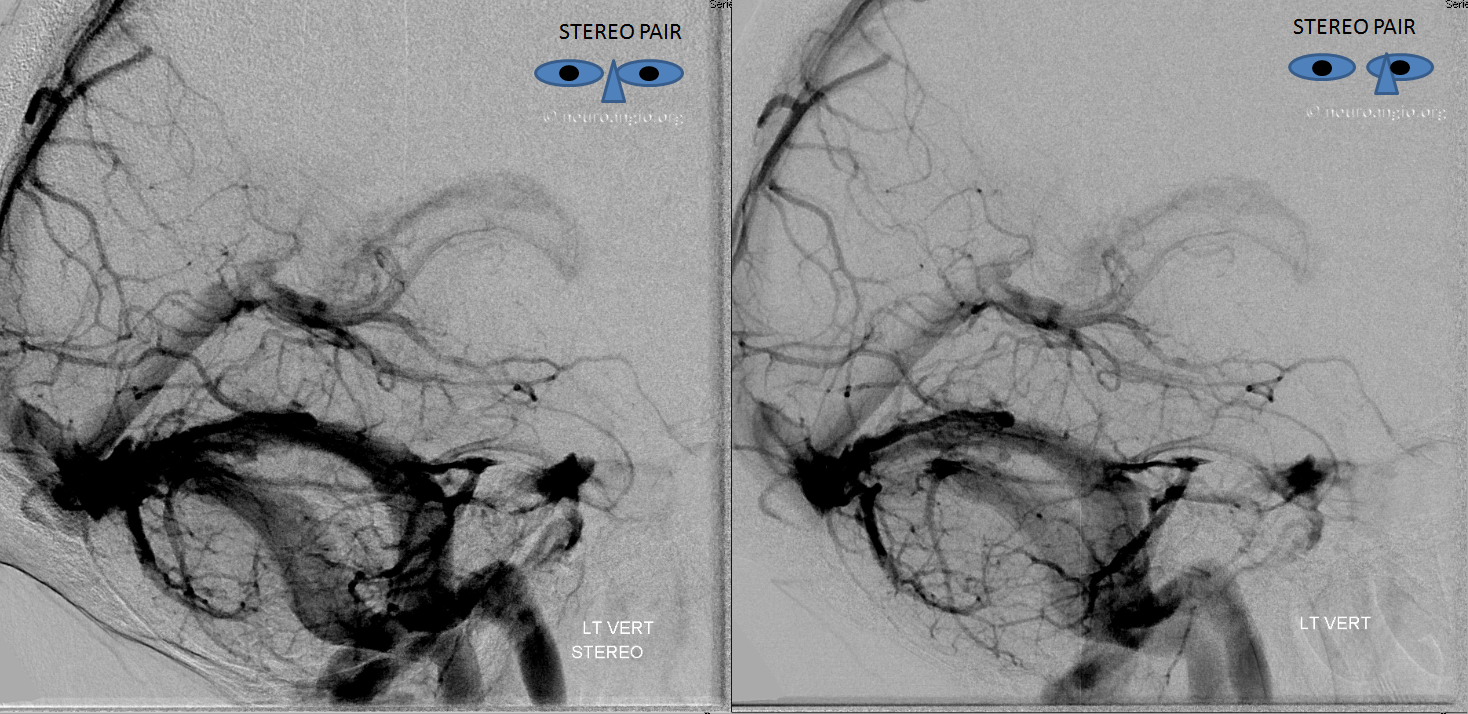 basal vein