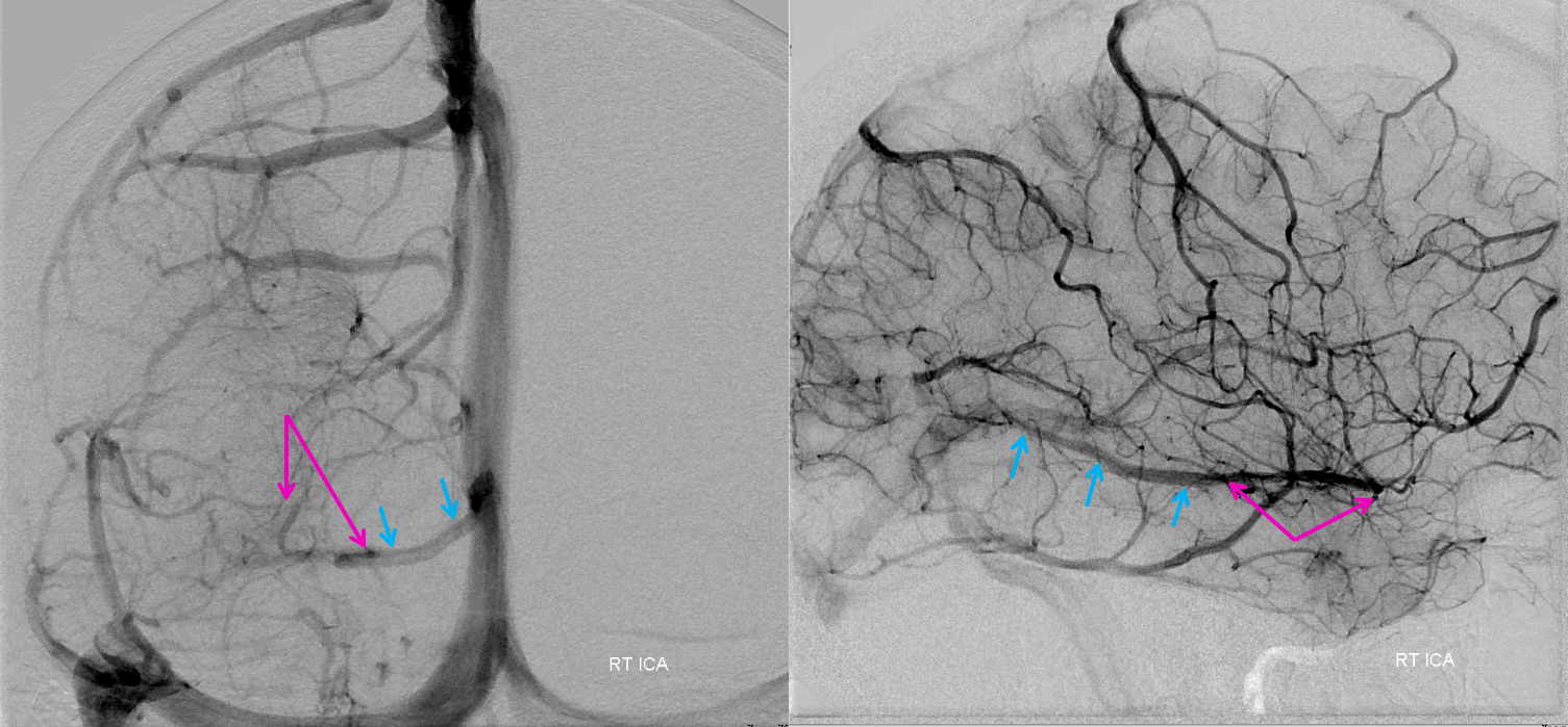 basal vein