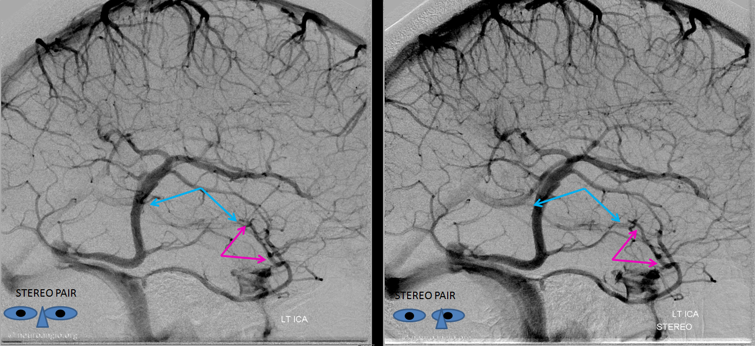 basal vein