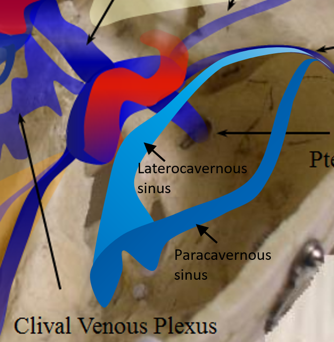 Carotid Cavernous Fistula Treatment Pregnancy Informations