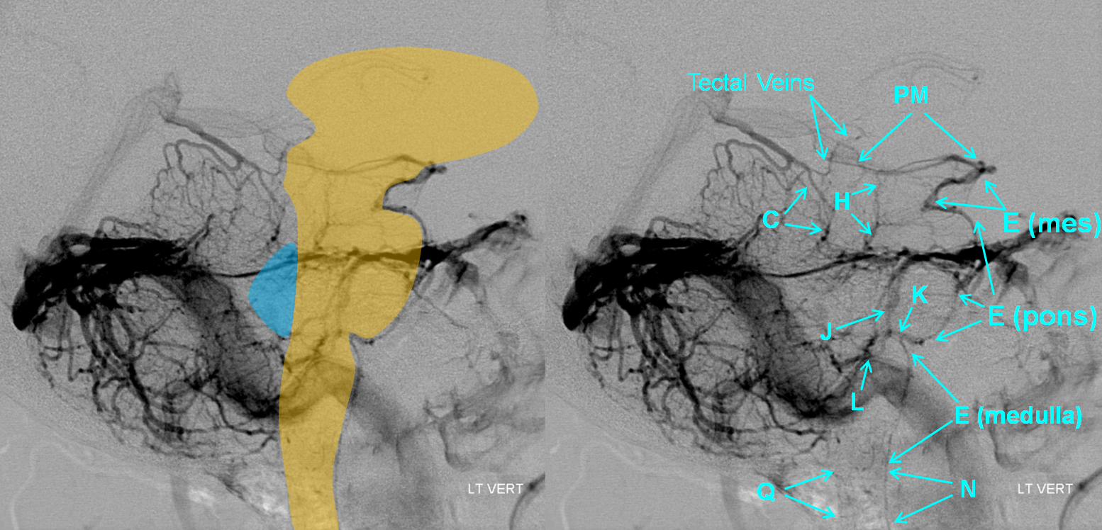 http://www.neuroangio.org/wp-content/uploads/Venous/Posterior_Fossa_Veins/V_anterior_group_brainstem_overlay.png