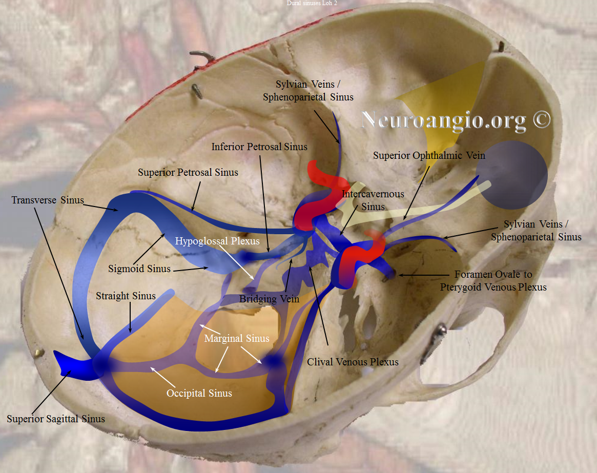 Cavernous Sinus Neuroangio