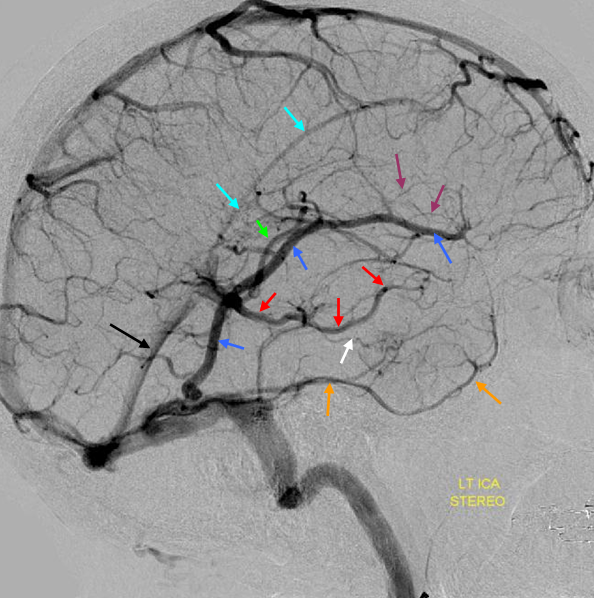 The larger superficial cerebral veins, including those draining the