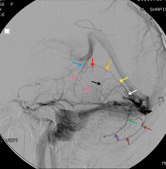 http://www.neuroangio.org/wp-content/uploads/Venous/V_vermis.png