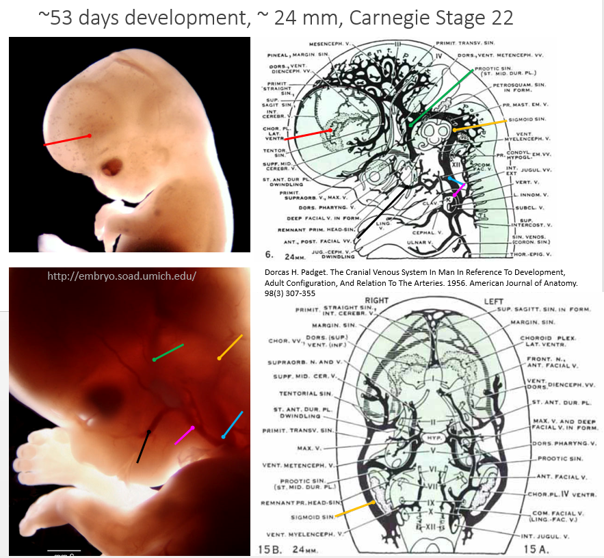 http://www.neuroangio.org/wp-content/uploads/Venous_Embryology/Venous_Embryology_neuroangio_14.PNG