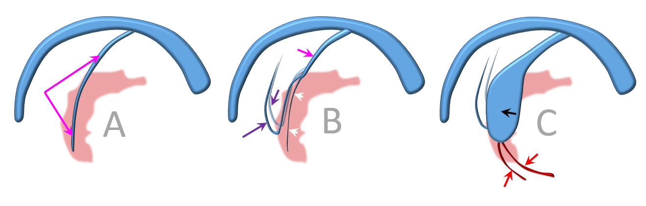 http://www.neuroangio.org/wp-content/uploads/Venous_Embryology/Venous_Embryology_neuroangio_15.PNG