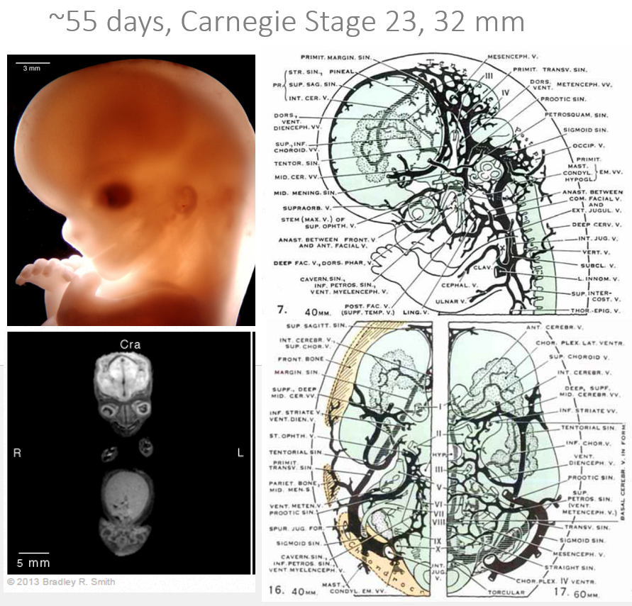 http://www.neuroangio.org/wp-content/uploads/Venous_Embryology/Venous_Embryology_neuroangio_17.PNG