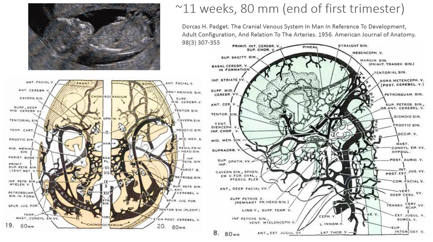 http://www.neuroangio.org/wp-content/uploads/Venous_Embryology/Venous_Embryology_neuroangio_18.PNG