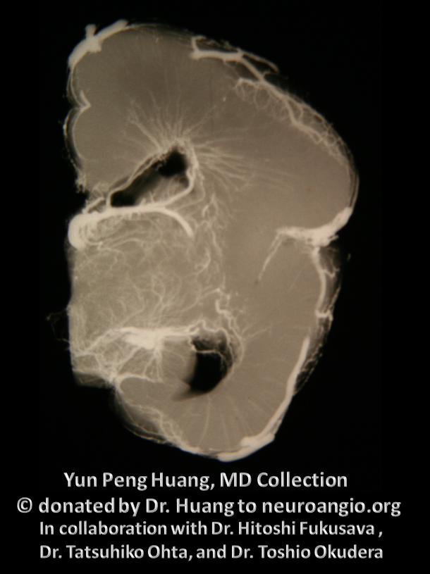 Yun Peng Huang Collection MVM DVA