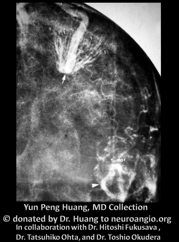 Yun Peng Huang Collection MVM DVA