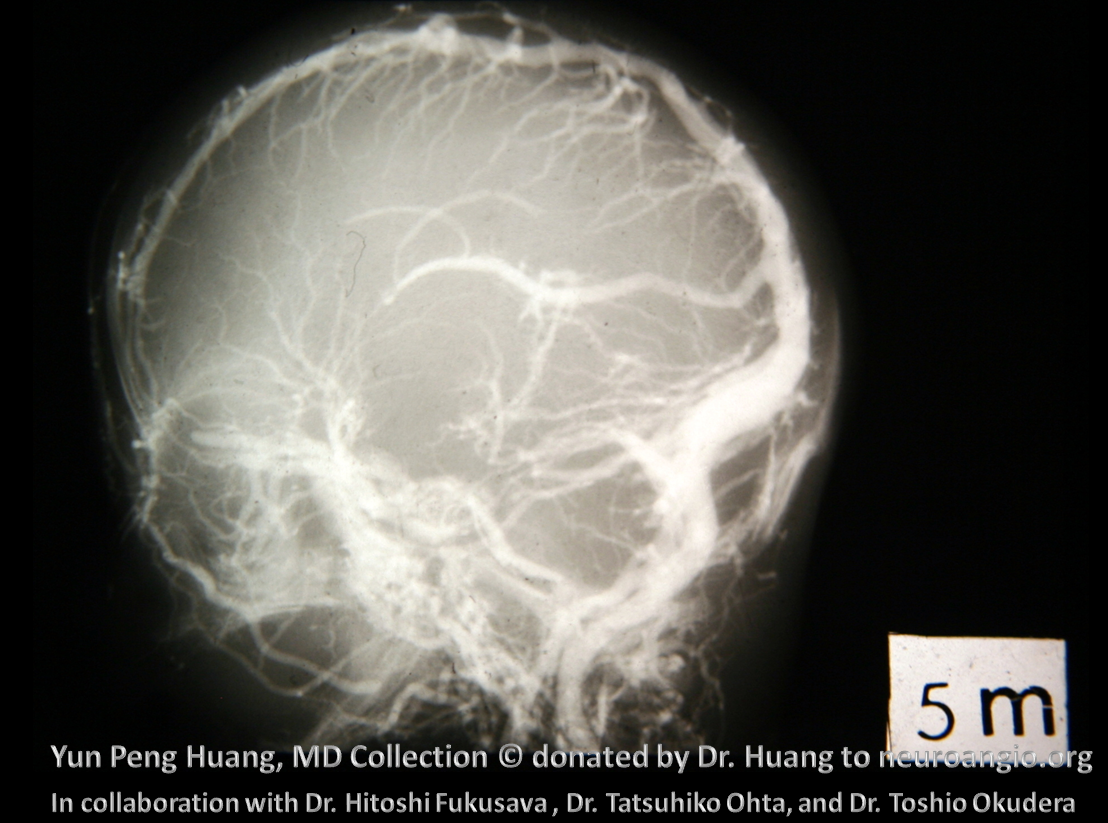 Yun Peng Huang Collection Embryology