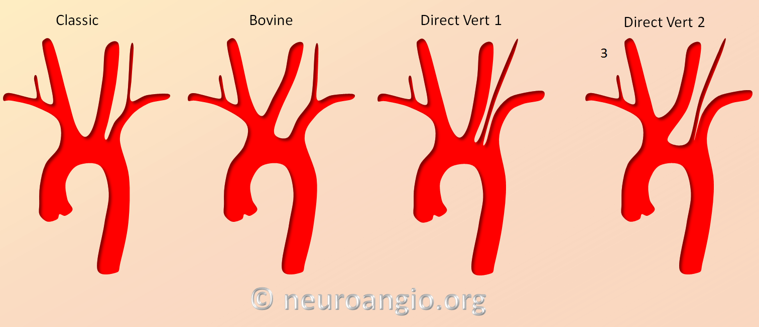 Aortic arch meaning - hrseka